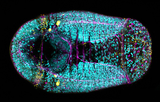 Microscopic image of annelid forming